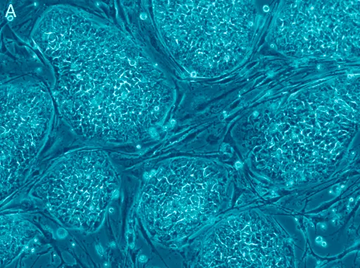 How to maximize the benefits of your Stem Cell Therapy