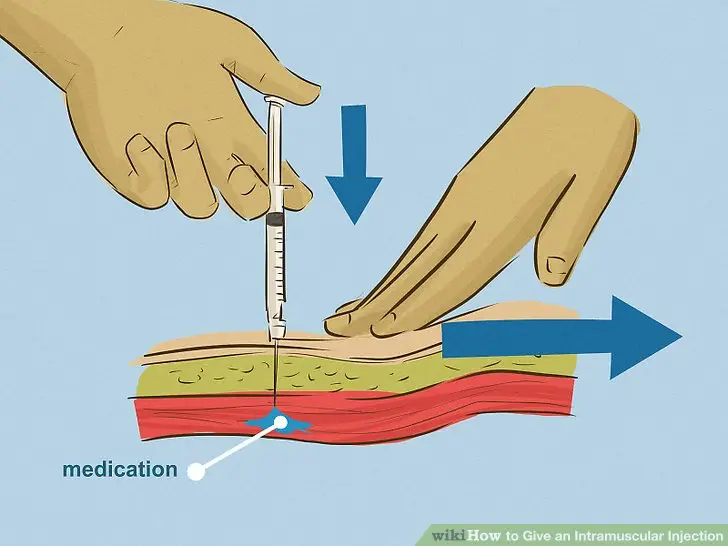 Intramuscular Injection