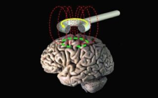 The workings of Repetitive transcranial magnetic stimulation (rTMS)