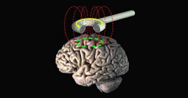 The workings of Repetitive transcranial magnetic stimulation (rTMS)