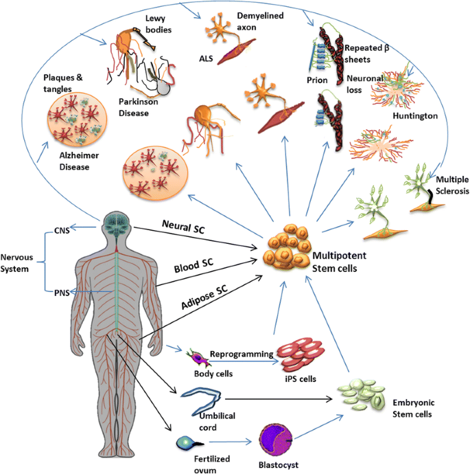 A chart illustrating the potential diseases stem cell treatments could address in the field of neurology.