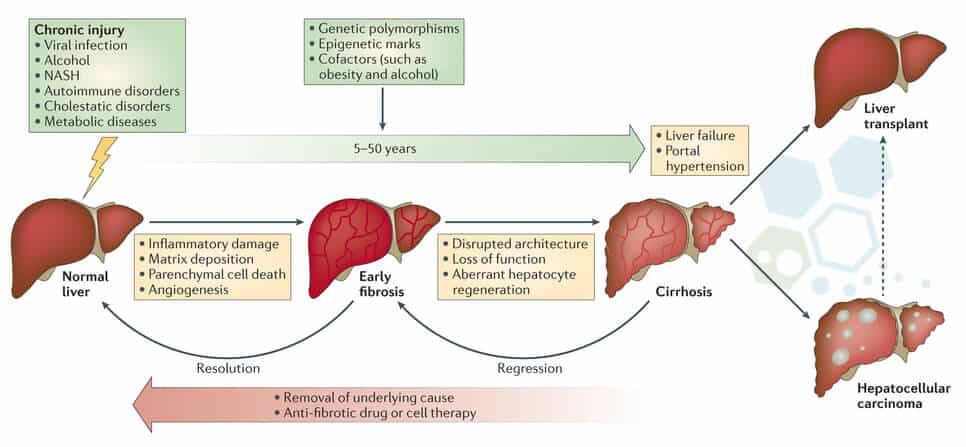 A chart showing the progress of patients before and after stem cell treatment for liver diseases