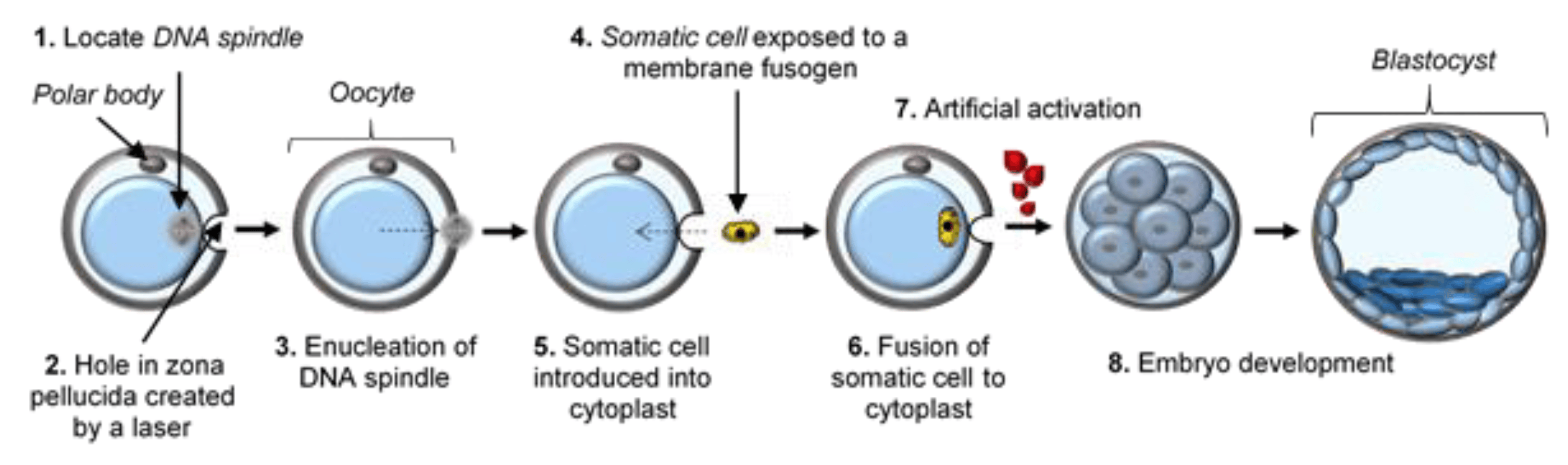 A diagram illustrating the process of stem cell research techniques such as somatic cell nuclear transfer, iPSCs creation, and use of ESCs