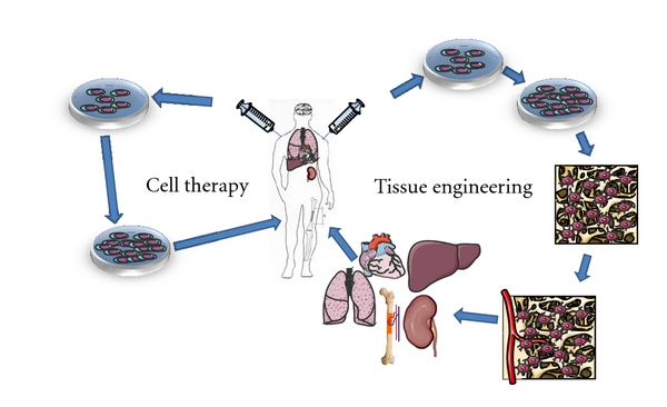 A diagram illustrating the process of stem cell therapy