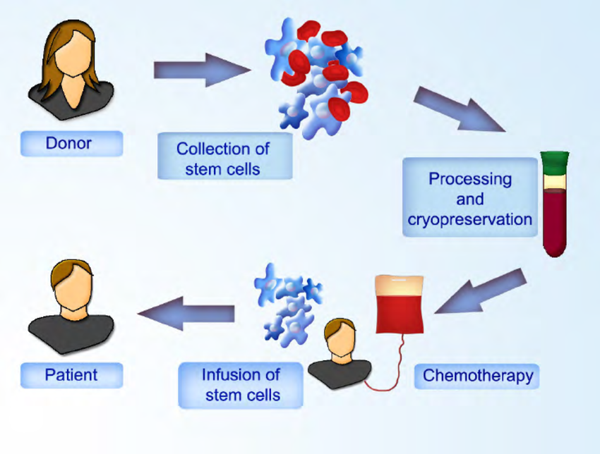 stem cell transplantation