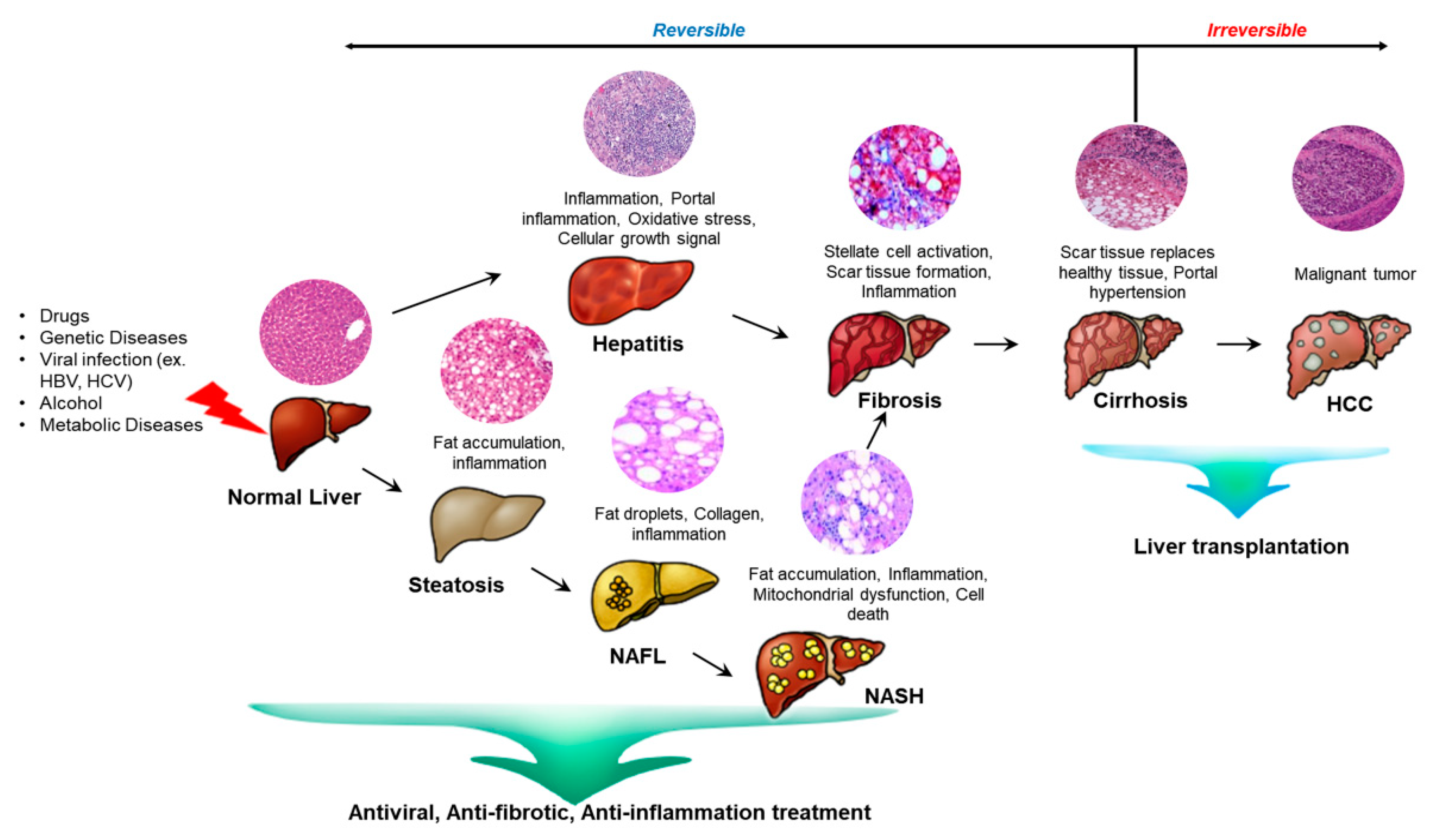 An infographic illustrating how stem cell treatment works in liver diseases