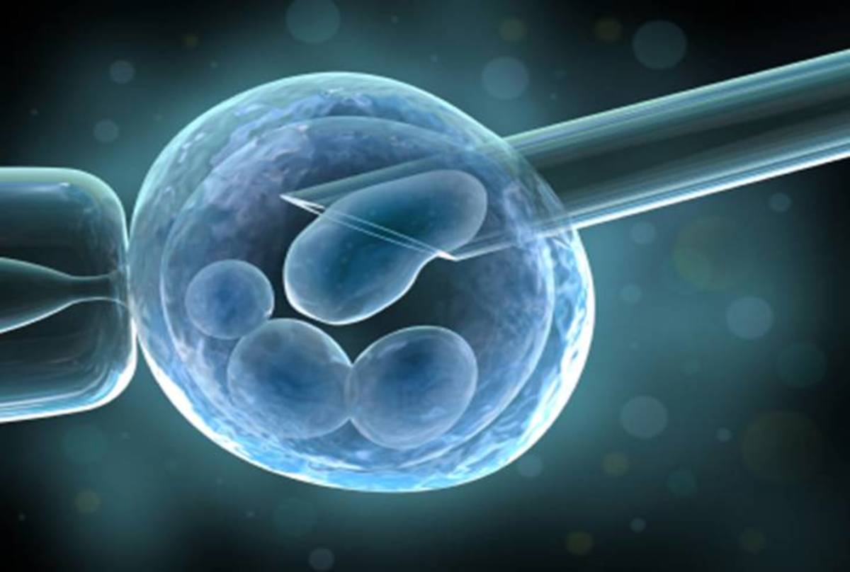 Stem cell extraction