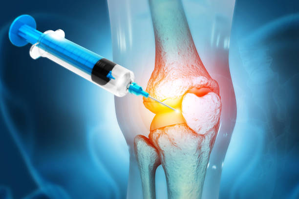 Knee injury treatment