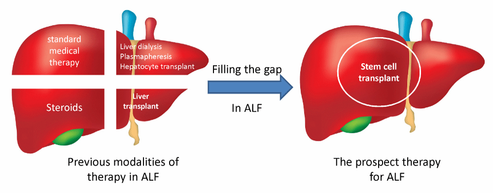 A futuristic image depicting the potential of stem cell treatment for liver diseases