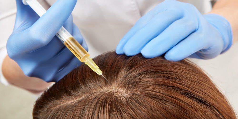 stem cell injection into the scalp.