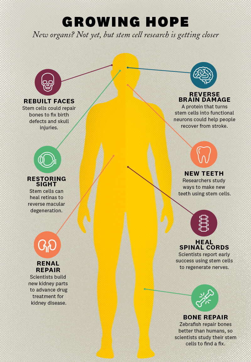 An infographic illustrating how stem cells can be used in anti-aging therapies