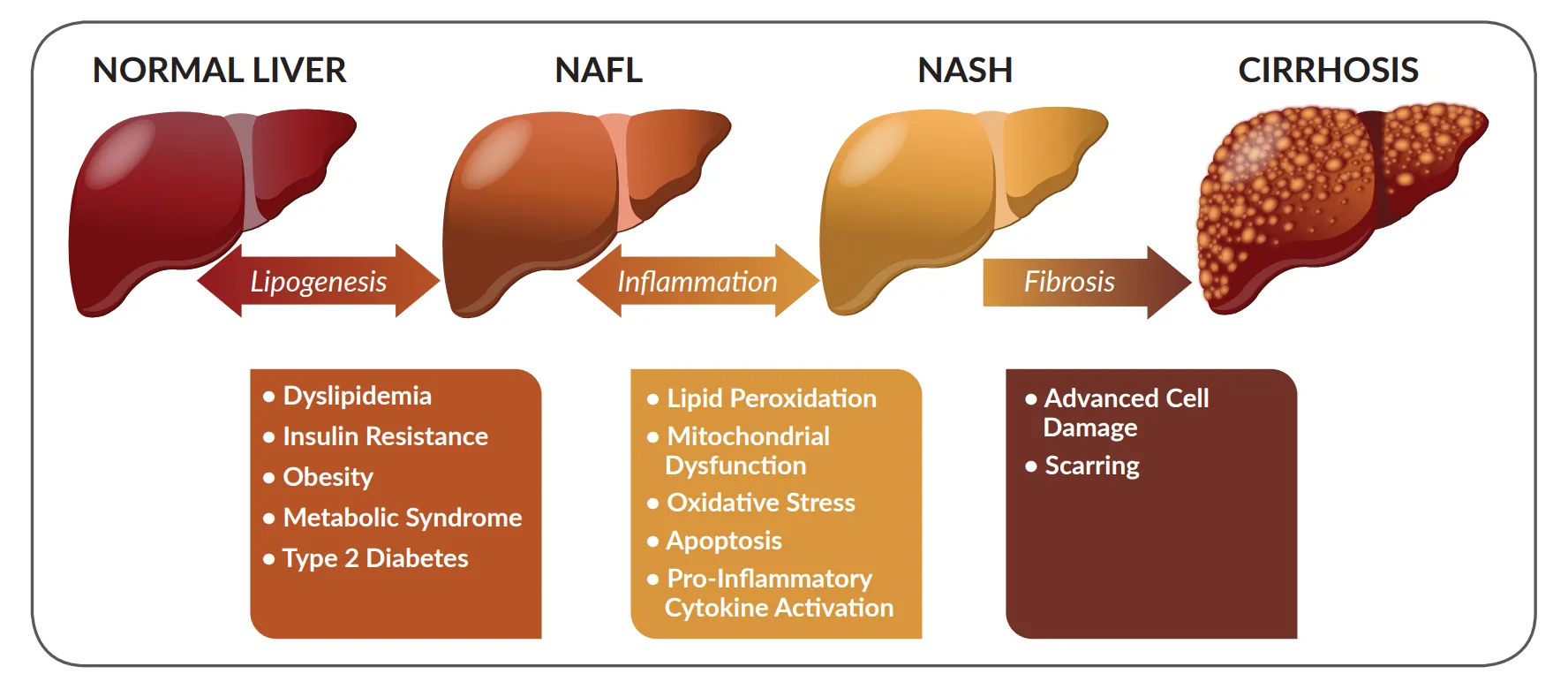 A chart illustrating various types of liver diseases and their potential impact on health